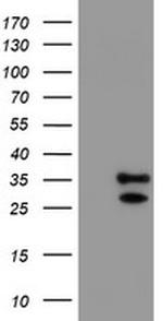 UCHL1 Antibody in Western Blot (WB)