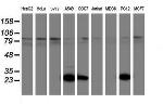 UCHL1 Antibody in Western Blot (WB)