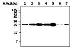 PGP9.5 Antibody in Western Blot (WB)