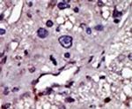 CMPK1 Antibody in Immunohistochemistry (IHC)