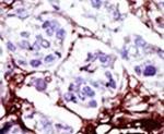 CMPK1 Antibody in Immunohistochemistry (IHC)