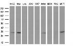 UCK1 Antibody in Western Blot (WB)