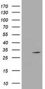 UCK1 Antibody in Western Blot (WB)