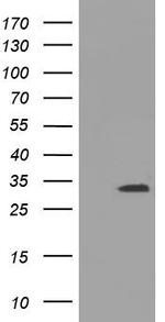 UCK1 Antibody in Western Blot (WB)