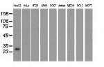 UCK1 Antibody in Western Blot (WB)