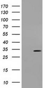 UCK1 Antibody in Western Blot (WB)
