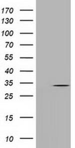 UCK1 Antibody in Western Blot (WB)