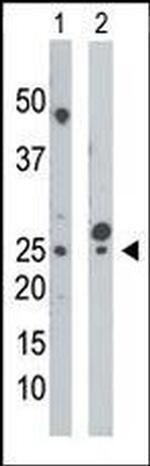 CMPK1 Antibody in Western Blot (WB)