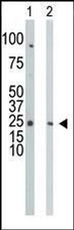 CMPK1 Antibody in Western Blot (WB)