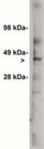 UGCG Polyclonal Antibody