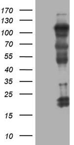UHRF2 Antibody in Western Blot (WB)