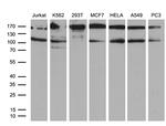 UHRF2 Antibody in Western Blot (WB)