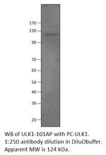 ULK1 Polyclonal Antibody