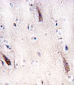 ULK2 Antibody in Immunohistochemistry (IHC)