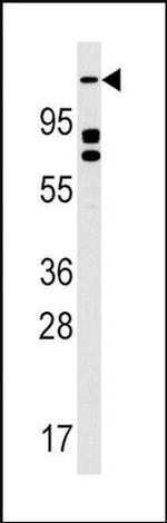 ULK2 Antibody in Western Blot (WB)