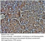 ULK4 Polyclonal Antibody