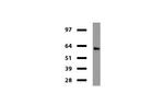 Desmin Antibody in Western Blot (WB)