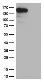 CPS1 Antibody in Western Blot (WB)