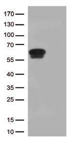 GPA33 Monoclonal Antibody (UMAB285), UltraMAB™