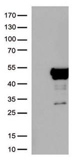 NSE (ENO2) Antibody in Western Blot (WB)