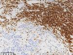 CD45 (PTPRC) Antibody in Immunohistochemistry (Paraffin) (IHC (P))