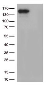 CPS1 Antibody in Western Blot (WB)