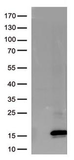 Melan A (MLANA) Antibody in Western Blot (WB)