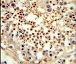 UNC119 Antibody in Immunohistochemistry (IHC)