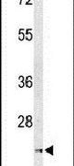 UNC119 Antibody in Western Blot (WB)