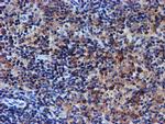 UNG Antibody in Immunohistochemistry (Paraffin) (IHC (P))