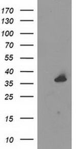 UNG Antibody in Western Blot (WB)