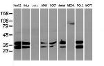 UNG Antibody in Western Blot (WB)