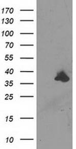 UNG Antibody in Western Blot (WB)