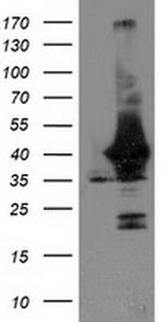 UNG Antibody in Western Blot (WB)