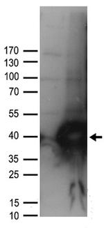 UNG Antibody in Western Blot (WB)
