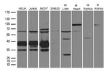 UNG Antibody in Western Blot (WB)