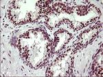 UPRT Antibody in Immunohistochemistry (Paraffin) (IHC (P))
