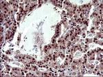 UPRT Antibody in Immunohistochemistry (Paraffin) (IHC (P))