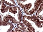 UPRT Antibody in Immunohistochemistry (Paraffin) (IHC (P))