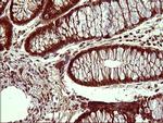 UPRT Antibody in Immunohistochemistry (Paraffin) (IHC (P))