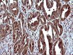 UPRT Antibody in Immunohistochemistry (Paraffin) (IHC (P))
