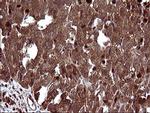 UPRT Antibody in Immunohistochemistry (Paraffin) (IHC (P))