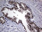 UPRT Antibody in Immunohistochemistry (Paraffin) (IHC (P))