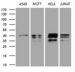 UPRT Antibody in Western Blot (WB)