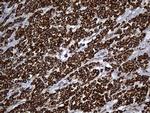 UQCRFS1 Antibody in Immunohistochemistry (Paraffin) (IHC (P))