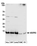 UQCRQ Polyclonal Antibody