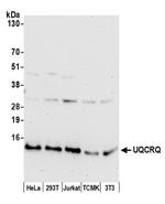 UQCRQ Polyclonal Antibody