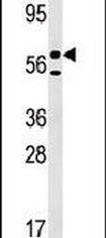 UCKL1 Antibody in Western Blot (WB)