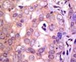 USP1 Antibody in Immunohistochemistry (IHC)