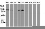 USP10 Antibody in Western Blot (WB)